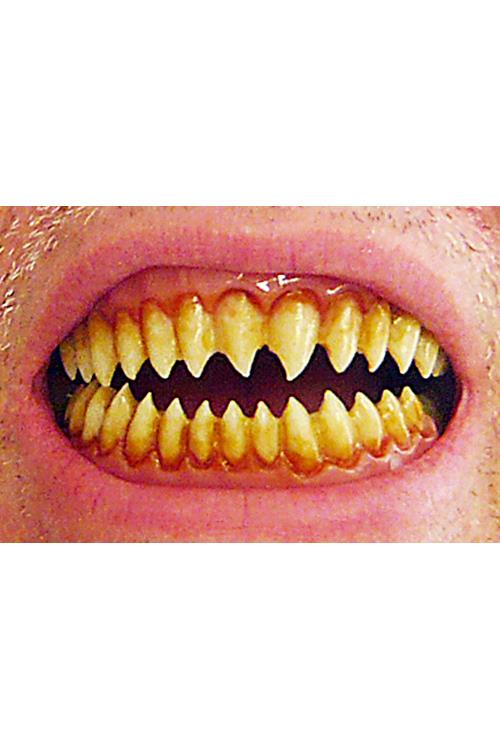 Dental Distortion - Teeth - Morlock β Paddywhack